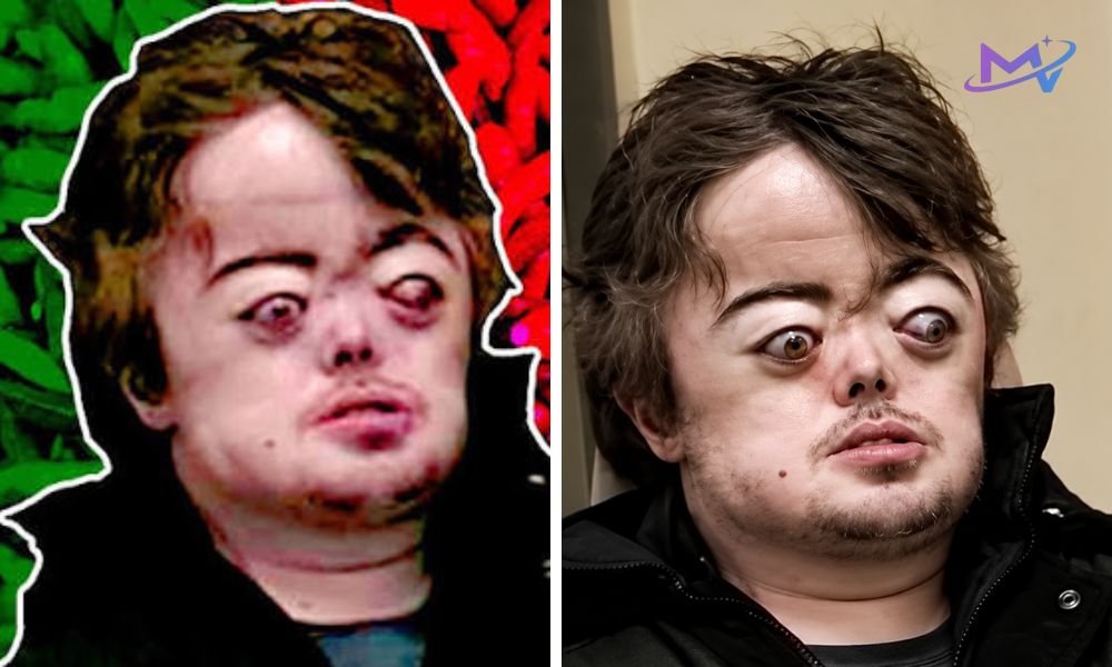 What Happened to Brian Peppers?